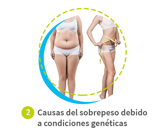 esquema visual con ilustraciones de una causa del sobrepeso