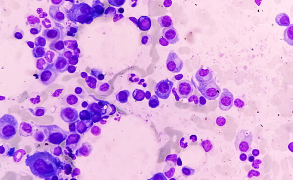 Patologías óseas más comunes en el adulto mayor | Aprende Institute